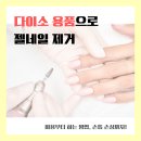 손톱가게 | [다이소 젤네일 셀프 제거] 쏙오프 용품 솔직 후기 | 손톱 손상은?