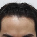 모먼트의원 이미지