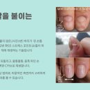 라온네일클리닉