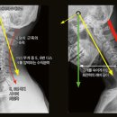 우리들신경외과