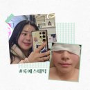 룩사인 | 삼전동웨딩관리 룩에스테틱 방문후기
