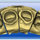 선명치과기공소 이미지