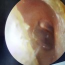 덕양 | 관산동보청기 벨톤보청기 고양덕양 보청기후기