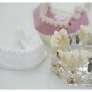 고려치과기공소 이미지