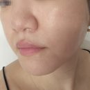 동진중학교 | 진해피부관리 여름모공관리 오늘도맑음에스테틱 피지관리후기