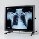 죽전본정형외과의원 | 으아, 무리했더니 삭신이 쑤시네? 양재 본 정형외과 뿌수기 후기