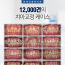 뷰티라인치과교정과치과의원 네이버블로그