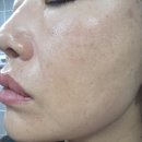 광명미백관리 잡티케어전문 골드미스 요즘파워토닝관리 색조 기미케어