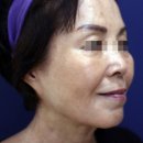 리뉴미 피부과 의원 이미지