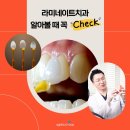 예쁜치아만들기치과의원 | 무삭제라미네이트 고민될 때, 신사역 치과 선택 체크사항 정리
