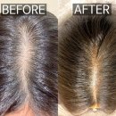 장전로6번길(3-358) | 📍청주 두피문신- 청주 SMP스튜디오 꼼꼼한 상담 자연스러운 문신 전문