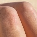 닭살이야 이미지