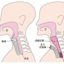 頸동맥 = 목부위 동맥 이미지