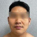 [홈케어] 3D 입체 HIFU 적용 뷰티 디바이스, 엑쎄라피 써클샷 내돈내산 솔직후기