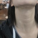 강남브이에스(VS)라인의원 | 일산 vs라인의원 브이에스라인의원 인모드 윤곽주사 후기