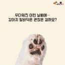 개발바닥 이미지