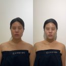 서현1동 소로3 | [서현] 분당에스테틱 추천 오직에스테틱, 서현역 수기 윤곽관리 웨딩관리 후기 (비포애프터 대만족)