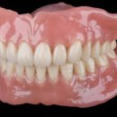 선치과기공소 이미지