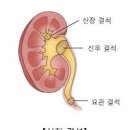 신장 결석 증상 신장 이상 원인 자가체크 방법 이미지