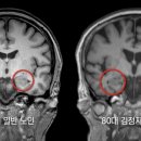 고령수퍼 - 서구 | 고령수퍼