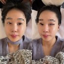 (유)희망케어 | 천안 두피관리 추천 두정동 두피케어 잘하는 곳 슬미로운