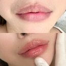 일산위시티 동물약국 | 일산 입술 아이브, 다크립 오버립 중화 통증 후기