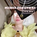 댕댕이를 부탁해 | 압구정역 피부과 e2레이저 여드름흉터 모공 피부결 개선 효과 후기