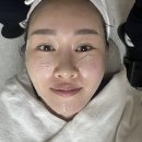 신논현 피부과 페어티타늄리프팅 효과 가격 주기 유지기간