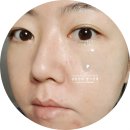닥터자르트 히알루론산앰플 촉촉한 구원템