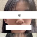 서울퀸성형외과의원 이미지