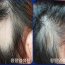 큐사랑 이미지