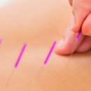 침산한의원 이미지