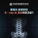 우리연세재활의학과의원 | 통증이 분명한데 X-ray는 정상? 종로3가 | 연세센트럴재활의학과