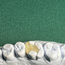 설 치과기공소 이미지