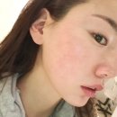 법원북로 | 사직동 피부관리, 거제동 에스테틱에서 받은 청담뷰티센터 싸이블로윤곽관리 후기