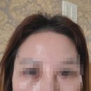 첨단지구피부관리 주름 관리가 필요하다면 수아르뷰티!