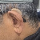 스타키보청기 안동점 이미지