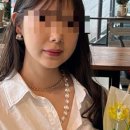 BBL쥴레이저 엑셀브이레이저후기 얼굴잡티 고민 해결