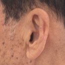 뉴이어보청기(대구센터) | 대구보청기 구입 후 청소와 점검, 꾸준한 관리가 중요한 이유