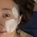 호한의원 | 부산 서면 새살침 | 예비신부의 여드름 흉터치료 한의원 방문 후기