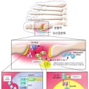 자가면역 질환 일어나는 ‘길목’을 찾다 이미지