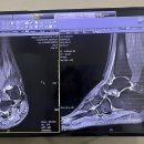 베스트신경외과의원 | 엑스레이, MRI 후기 / 족압검사, 맞춤형 깔창 가격 / 베스트신경외과, 정형외과, 9988병원 / 도수치료...