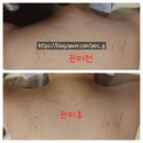 세븐일레븐 수유도봉로점 | [강북] 수유역 웨딩케어 승모근 피부관리 잘하는 얼짱몸짱 수유점 방문 솔직후기