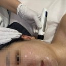 대구피부관리 건하뷰티 | 붓기 싹 빼고 온 후기