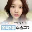 하이엔드성형외과의원 이미지