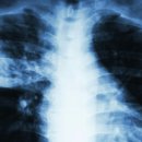 유엔아이메디컬 이미지