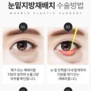 함박눈성형외과의원 이미지