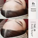 제이비라인 이미지