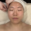 퍼스트피시카페 | 방배피부관리 자월에스테틱 후기 방배여드름관리 서초여드름압출까지 체계적이었던 곳