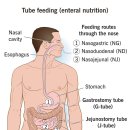 엔커버